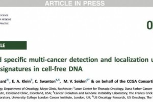 新式血液测验可完成50多种癌症早发现早定位