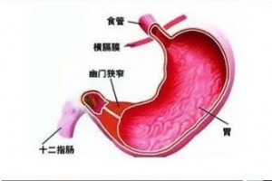 胃十二指肠溃疡怎么治作用最好